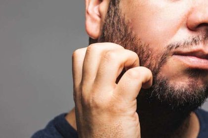 démangeaison barbe
