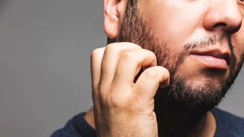 démangeaison barbe